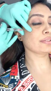 Surabhi Prabhu Instagram - #skintreatment #skinhydration #collagen 
The 2nd session of Profhilo with @guptaprathamesh at Dr. Marwah’s clinic @drmarwahsclinic proved to be another delightful experience. Under the expert guidance of Dr. Marwah, and with the gentle touch of the treatment, my skin was left feeling rejuvenated and youthful once again. The procedure was painless and efficiently completed in minimal time. Instantly, I noticed a significant improvement in my skin’s health, including enhanced hydration and elasticity. Dr. Marwah’s professionalism and meticulous attention to detail were truly praiseworthy, making the entire experience thoroughly enjoyable. I wholeheartedly recommend this treatment to anyone seeking to revitalize their skin.
.
.

#ad #paidcollaboration 

.
@almalasers_india
@profhilo_india

#HyaluronicAcid #Aesthetic #AlmaForAll #Beauty #BioRemodelling #Hydration #Profhilo
#surabhiprabhu #prabhu #surabhi #drmarwahsclinic #drgurjotmarwah #skincare #skinhydration #facetreatment #wrinkleremoval #filler #botox #skinclinicmumbai #mumbaiskinclinic #beautyblogger #skindoctorclinics #antiage #antiageing

@almalasers_india
@profhilo_india
@drprathmesh
@drmarwahsclinic