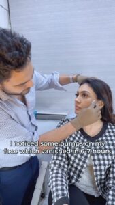 Surabhi Prabhu Instagram - The 1st sitting for Profhilo with @dr.gurjotmarwah at Dr. Marwah’s clinic was a rejuvenating experience. The expert guidance of Dr. Marwah and the gentle touch of the treatment left my skin feeling refreshed and youthful. The treatment was painless, I did not even felt the needle and it took very minimal time.
It is not a dermal filler but a revolutionary moisturizing treatment that delivers Hyaluronic Acid deep into the skin and helps the skin glow naturally.
I could see an instant boost in my skin health, with improved hydration and elasticity. Dr. Marwah’s professionalism and attention to detail were truly commendable, making the entire experience a pleasant one. I am already looking forward to my next session with him and would highly recommend this treatment to anyone looking to revitalize their skin.
@almalasers_india
@profhilo_india
@dr.gurjotmarwah
@drmarwahsclinic

#ad #paidcollaboration 

#HyaluronicAcid #Aesthetic #AlmaForAll #Beauty #BioRemodelling #Hydration #Profhilo
#surabhiprabhu #prabhu #surabhi #drmarwahsclinic #drgurjotmarwah #skincare #skinhydration #facetreatment #wrinkleremoval #filler #botox #skinclinicmumbai #mumbaiskinclinic #beautyblogger #skindoctorclinics #ad #antiageing