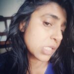 Kasthuri Shankar Instagram - Say hello to my little friends ! #pockmarks Adult Chickenpox is a bitch. Life threatening at most and certainly disfiguring at best. I am lucky that my eyes were spared. Thanks to those who stood by me. Forever grateful. I hope my instafam will continue to love and support. After a lifetime of spotless smooth skin, now I have to get used to the new normal. Sighhh.