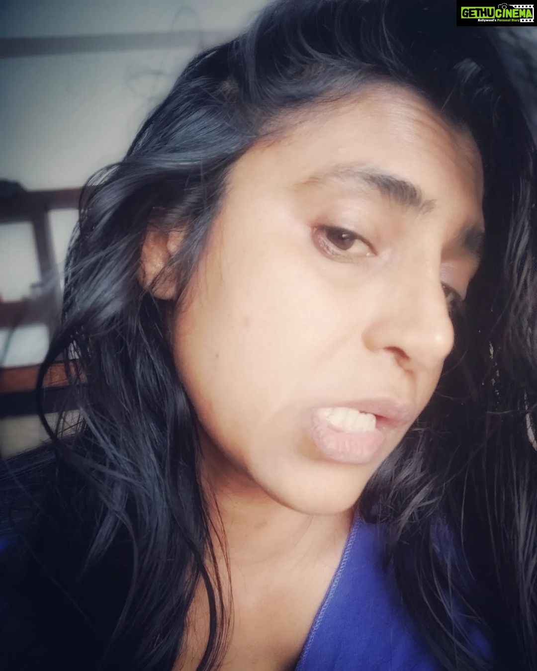 Kasthuri Shankar Instagram - Say hello to my little friends ! #pockmarks Adult Chickenpox is a bitch. Life threatening at most and certainly disfiguring at best. I am lucky that my eyes were spared. Thanks to those who stood by me. Forever grateful. I hope my instafam will continue to love and support. After a lifetime of spotless smooth skin, now I have to get used to the new normal. Sighhh.