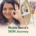 Mukta Barve Instagram - Glad to have @muktabarve in our clinic. Her smile bought different positivity in the clinic. It’s fun to treat her😍 #celebrityinclinic #celebrityskincare #celebrityskincaresecrets #skintreatment #skincareroutine #dermatologistrecommended #skincarebydermatologist #skinclinics #thaneskinclinic #goodskintips #goodskingoodmood #goodskincarehabits #goodskinaddict #goodskinstartshere #healthyskinishappyskin #goodskinhappylife #goodskinbeauty #letsgetglowing #goodskinforlife #goodskinisin #goodskindays #healthyskinessentials #drtanvivaidya #dermamdclinics #thanecity Thane, Maharashtra