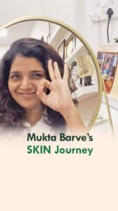 Mukta Barve Instagram - Glad to have @muktabarve in our clinic.

Her smile bought different positivity in the clinic. It’s fun to treat her😍

#celebrityinclinic #celebrityskincare #celebrityskincaresecrets #skintreatment #skincareroutine #dermatologistrecommended #skincarebydermatologist #skinclinics #thaneskinclinic #goodskintips #goodskingoodmood #goodskincarehabits #goodskinaddict #goodskinstartshere #healthyskinishappyskin #goodskinhappylife #goodskinbeauty 
#letsgetglowing #goodskinforlife #goodskinisin #goodskindays #healthyskinessentials #drtanvivaidya #dermamdclinics #thanecity