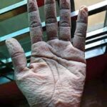 Shirish Sharavanan Instagram - This is the hand of a doctor after removing his medical precautionary suit and gloves after 10 hours of duty. Salute to the frontline heroes.👍🙏 #covid19 #lockdown #chennai