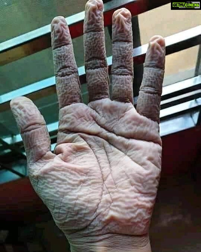 Shirish Sharavanan Instagram - This is the hand of a doctor after removing his medical precautionary suit and gloves after 10 hours of duty. Salute to the frontline heroes.👍🙏 #covid19 #lockdown #chennai