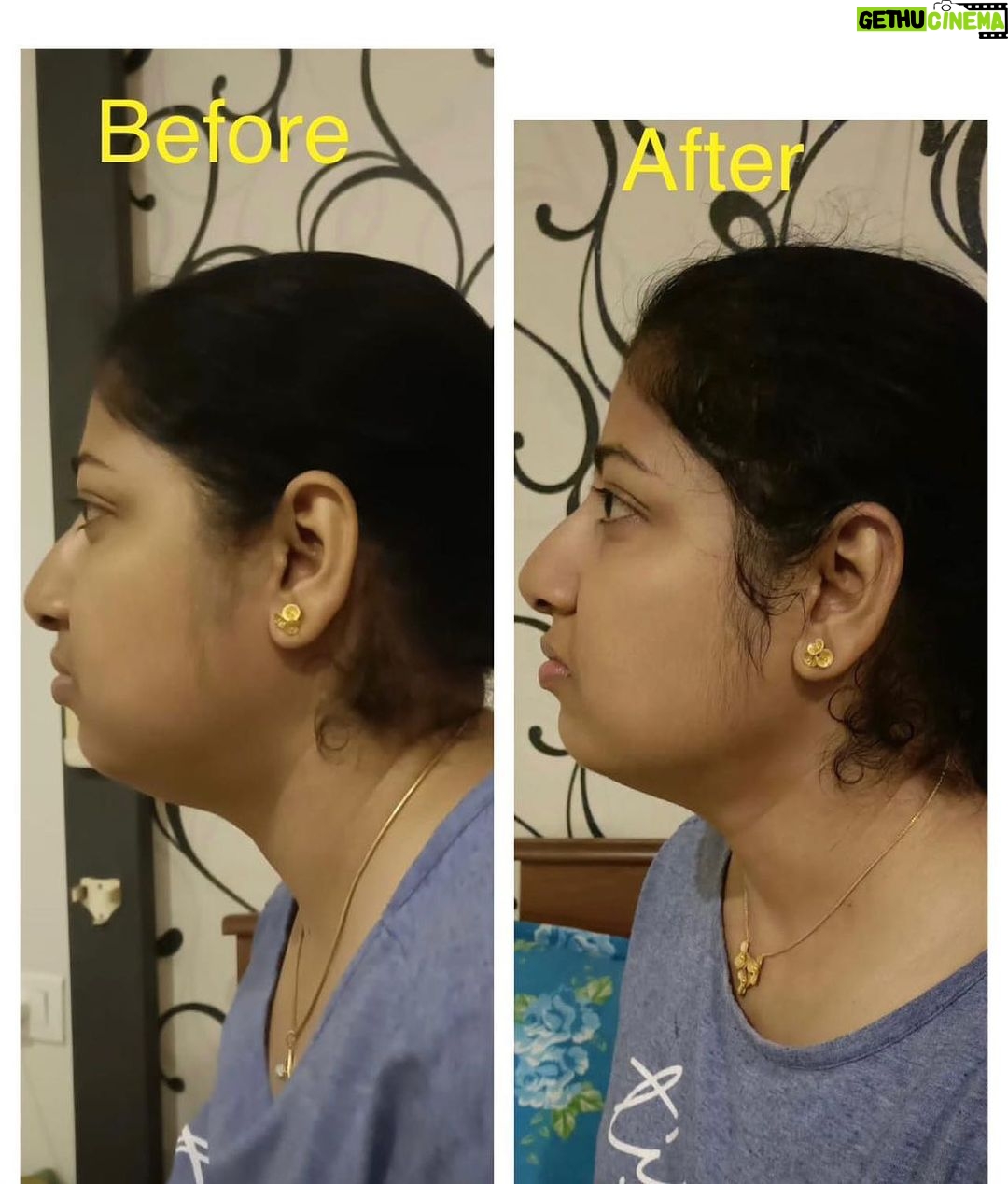 Gauri Pradhan Tejwani Instagram - Progress in 10 sessions. #OorjaByGauri #faceyoga #transformation #pranayama New face yoga batches starting from tomorrow, 12th of June