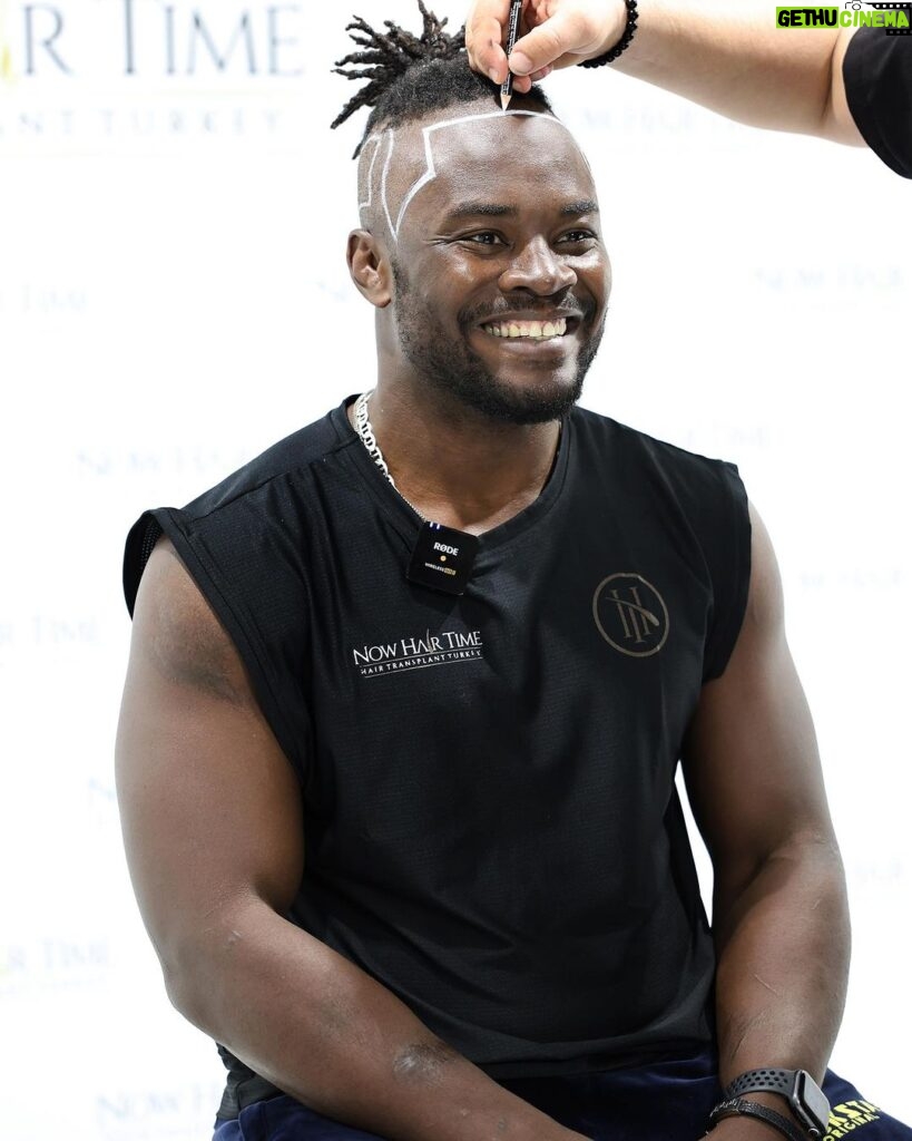 Abdul Razak Alhassan Instagram - Just getting back from Turkey for one of the most awesome experiences I’ve had. Thank you @melikyagmur_ And @now.hairtime for the great hospitality! Treatment and the staff and everything was above and beyond. 5 star treatment. Had an amazing time. Can’t wait to see the progress on my hair 👊🏿. Thank you again @now.hairtime İstanbul Turkey