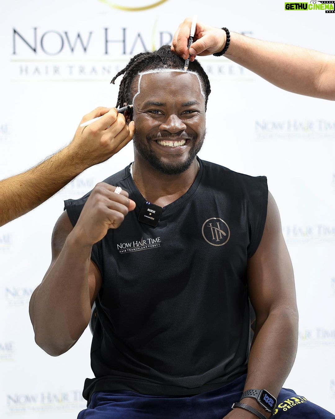 Abdul Razak Alhassan Instagram - Just getting back from Turkey for one of the most awesome experiences I’ve had. Thank you @melikyagmur_ And @now.hairtime for the great hospitality! Treatment and the staff and everything was above and beyond. 5 star treatment. Had an amazing time. Can’t wait to see the progress on my hair 👊🏿. Thank you again @now.hairtime İstanbul Turkey