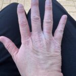 Ali Bastian Instagram - There’s no doubt about it, we are an atopic family… I’ve had eczema for as long as I can remember and my little girl Isla has eczema and multiple severe food allergies. Being an allergy Mamma I’m washing my hands constantly when preparing food or when coming into contact with any of Isla’s allergens. As a result, my hands have such bad eczema flares… At times they even crack and bleed. I feel so self conscious about it and I know amongst other things, it can look so ageing! I was previously prescribed @doublebaseuk by my Dr and find it brilliant for the day to day management of my eczema. I have recently discovered Doublebase Dry Skin Hand Wash and thought I would put it to the test for seven days by replacing my usual soap. I also used Doublebase Dry Skin Emollient after washing my hands. Have a swipe through my photos to see the results!! At the beginning of the week my hands were so dry and cracked… full disclosure, I’m a busy Mamma and I didn’t manage to use the emollient EVERY time but having the intention meant I did it SOME of the time which was enough to make a huge difference. Anyone with eczema knows there aren’t many quick fixes and consistency is key but already my hands are softer, no more painful cracks in the skin and looking younger already! Doublebase Dry Skin Hand Wash is definitely going to be part of my eczema care routine moving forward and what’s also fab is that @Doublebaseuk products are easier to get hold of from places such as Boots. #Doublebase #Eczema #Psoriasis #Dermatitis #Doublebasedifference #AD