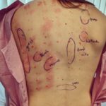 Alison Haislip Instagram - WARNING: Swipe ONLY if you want to see how allergic I am to the outdoors. Turns out, I'm allergic to basically all trees and grass. And while I've always had mild allergies, the ungodly rain SoCal had at the beginning of the year has triggered an allergy in me like I have never known...I have absolutely NO sinus issues, but if I don't take an antihistamine every other day, I break out in hives. It's insane. So if @zyrtecallergy is looking to sponsor someone this allergy season, I'd love to throw my hat in the ring. (Oh and don't worry about that tiny circle that says dogs up in the corner. That's only a mild allergy. Thankfully I can still snuggle all doggos.)