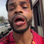 Andrew Bachelor Instagram - Ouch 🎤