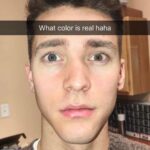 Andrew Neighbors Instagram - It’s that time of year again! I get a lot of people asking about costume contact lenses. Generally I’d say skip them, they aren’t worth the risk (see the corneal ulcer on the last slide that can cause permanent scarring /blindness from an incorrectly worn contact lens) But if you reallllyyyy wanna wear them, they still need to be fitted and checked by an optometrist. If the doctor isn’t sure of any brands, I’ve had some luck with the “gothika” website/brand. But they NEED to be done by your eye doctor!! Stay safe and protect ur eyeballs.