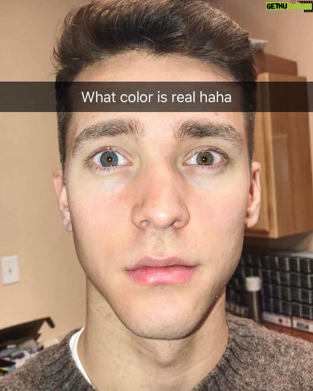 Andrew Neighbors Instagram - It’s that time of year again! I get a lot of people asking about costume contact lenses. Generally I’d say skip them, they aren’t worth the risk (see the corneal ulcer on the last slide that can cause permanent scarring /blindness from an incorrectly worn contact lens) But if you reallllyyyy wanna wear them, they still need to be fitted and checked by an optometrist. If the doctor isn’t sure of any brands, I’ve had some luck with the “gothika” website/brand. But they NEED to be done by your eye doctor!! Stay safe and protect ur eyeballs.