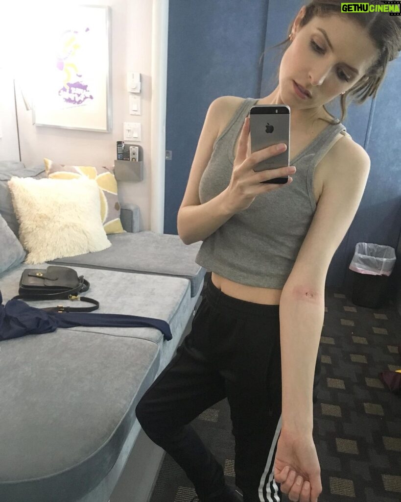 Anna Kendrick Instagram - She’s not afraid of 💉💉 but she bruises like a 🍑