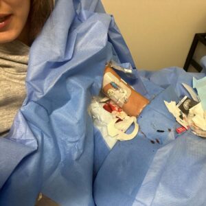 Bella Hadid Instagram - the little me that suffered would be so proud of grown me for not giving up on myself🫶🏼

Thankful to my mommy for keeping all of my medical records, sticking by me , never leaving my side, protecting, supporting , but most of all, believing me through all of this 

Living in this state, worsening with time and work while trying to make myself, my family and the people who support me, proud, had taken a toll on me in ways I can’t really explain. To be that sad and sick with the most blessings/privilege/opportunity/love around me was quite possibly the most confusing thing ever. one thing I want to express to you all is that 1: I am okay and you do not have to worry, ♥️and 2:I wouldn’t change anything for the world. If I had to go through all of this again, to get here, to this exact moment I’m in right now, with all of you, finally healthy, I would do it all again. It made me who I am today. 

The universe works in the most painful and beautiful ways but I need to say that if you are struggling- it will get better. I promise. take a step away, stay strong, have faith in your path, walk in your truth and the clouds will start to clear up. I have so much gratitude for and perspective on life , this 100+ days of Lyme, chronic disease , co infection treatment, almost 15 years of invisible suffering, was all worth it if I’m able to, God willing, have a lifetime of spreading love from a full cup, and being able to truly be myself, For the first time ever 

I tried to pick the most positive pictures I could because as painful as this experience was, the outcome was the most enlightening experience of my life filled with new friends, new visions and a new brain 

Thank you for the patience of the incredible company’s that I work for , my supporters and the people who continued to check in. My agents Jill and Joseph for protecting me. I love and appreciate you more than I can ever express

Thank you to my genius Dr, and her INCREDIBLE team of nurses. I love you SO much!!!

I’ll be back when I’m ready

I miss you all so much 

I love you all so much