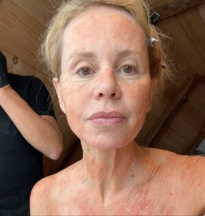 Carole Richert Instagram - Mais que m’arrive-t’il ? 🥵🥵🥵🥵 Merci  au chef maquilleur #emmanuelpitois  pour ses effets spéciaux époustouflants . Ma brûlante transformation promet de faire effet!!! #tournage #viedactrice #tvfilm #francetelevision #coupdechaud