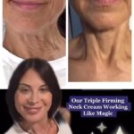 Catherine Bell Instagram - Unretouched before and after!! One of our very happy 57 year old customers necks !! 🥰❤️ it really is MAGIC 🪄 @everliving.beauty #skincare #antiaging #youthfulskin