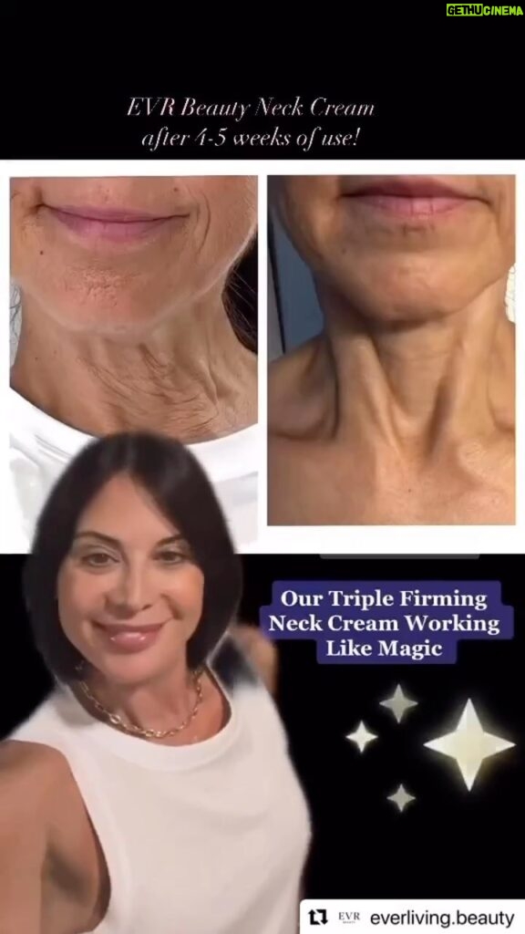 Catherine Bell Instagram - Unretouched before and after!! One of our very happy 57 year old customers necks !! 🥰❤️ it really is MAGIC 🪄 @everliving.beauty #skincare #antiaging #youthfulskin
