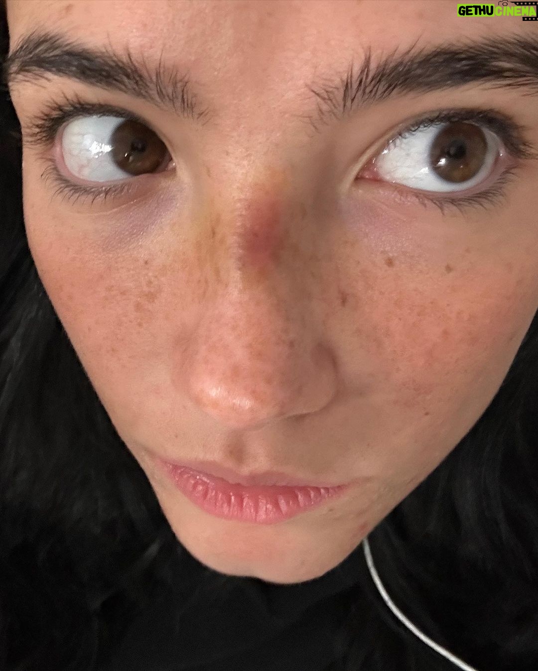 Charli D'Amelio Instagram - i bonked my head 🤕