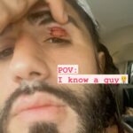 Charlie Decca Instagram - If you ever need a doctor dm me. I know a guy 🥸 I refuse to go to a doctor if it is 5 stiches and under So super glue and tape it is. • • • • • #boxing#mma#miami#hialeah#warfare#territory#latenight#mybeach#mysun#myterritory#itsmine#fights#streetfights#fightnews#blood#hardwork#smartwork#305#dadecounty#weekendvibes#doctor#stiches#iknowaguy #suture#drdecca#doityourself