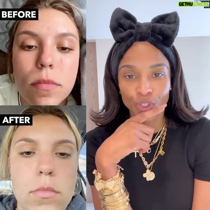 Ciara Instagram - When I said I was on a mission, I meant that! So proud of these amazing results from my OAM skincare line!! ✨✨ I love seeing your glow up pictures! Keep sending them in!! Let’s go!! #oamskin @oamskin