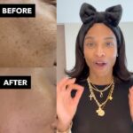 Ciara Instagram - When I said I was on a mission, I meant that! So proud of these amazing results from my OAM skincare line!! ✨✨ I love seeing your glow up pictures! Keep sending them in!! Let’s go!! #oamskin @oamskin