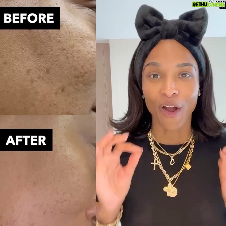 Ciara Instagram - When I said I was on a mission, I meant that! So proud of these amazing results from my OAM skincare line!! ✨✨ I love seeing your glow up pictures! Keep sending them in!! Let’s go!! #oamskin @oamskin