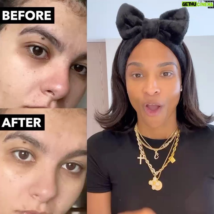 Ciara Instagram - When I said I was on a mission, I meant that! So proud of these amazing results from my OAM skincare line!! ✨✨ I love seeing your glow up pictures! Keep sending them in!! Let’s go!! #oamskin @oamskin