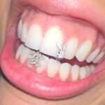Doja Cat Instagram - 🧢 @_4_f_s_b_ 🦷 @gabbyelanjewelry