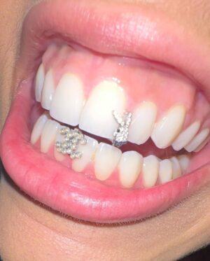 Doja Cat Instagram - 🧢 @_4_f_s_b_ 🦷 @gabbyelanjewelry