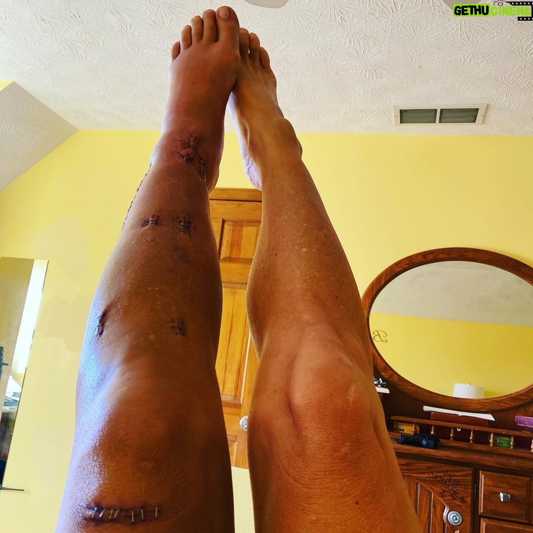Eaddy Mays - 3.6K Likes - OK, so I’m starting this post with a really goofy picture of me so that if you are easily grossed out or have a weak stomach DO NOT look at any more pictures in this post. Got it?!! I totally did an @spiderandersonsilva 😣 The pix are kinda gross (but I think it’s cool LOL so I’m sharing it with you.) Also, I’m looking for Sci-Fi reading recommendations! Put ‘em in the comments, please. Ok. Be smart (smarter than me! LOLOL) and we’ll connect soon 😘😘😘