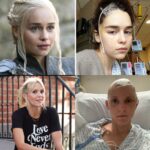 Emilia Clarke Instagram - Brain injury will affect 1/3 people in their lifetime. That’s one-third of all people globally. Not just the elderly or the catastrophically unlucky. Even the fantastically lucky who survive major brain injuries, like the amazing @emilia_clarke - who was very young, 24, when her first aneurysm began bleeding - or (young-ish) me - I was 38 when a previously undetected AVM ruptured, ending my ability to speak, compute language, move my right side; in short my life as I knew it. Recovery from brain injury is an exhausting, complex, complicated, multi-factorial and well-nigh 24/7 constant struggle, even for those of us who have the privilege of getting to try. But brain injury is still not talked about. And provision of vital services and care are not prioritised, even for the young people who might be able to give back to their communities and societies in a very meaningful way in the future. Long-term critical neuro-rehabilitation and support are - even in the most medically advanced societies like the US and UK - practically nonexistent. That’s why @emilia_clarke founded @sameyouorg with her amazing mum Jenny. And thanks to the phenomenal generosity of an anonymous donor in New York, *for the next 24 hours only*, ANY pledge of any donation, large and small, with no limit, will be 100% matched. That is unbelievable. The match offer will finish tomorrow night, Friday 17th February. Obviously, we would be grateful to have your donation anytime, but if you have ever thought of supporting this very worthwhile cause, it would mean the world to us if you could find it in your heart to support SameYou’s vital mission and dig deep into your pockets TODAY to maximise the power of your donation. I hate to scaremonger/point out the obvious, but on those odds, 1/3 of all people, it’s probably not unlikely that you or someone you love will need care for brain injury at some point in the future. Thank you for all your support. It is so appreciated. Link in bio or visit SameYou.org 🙏🧠♥️ #braininjury
