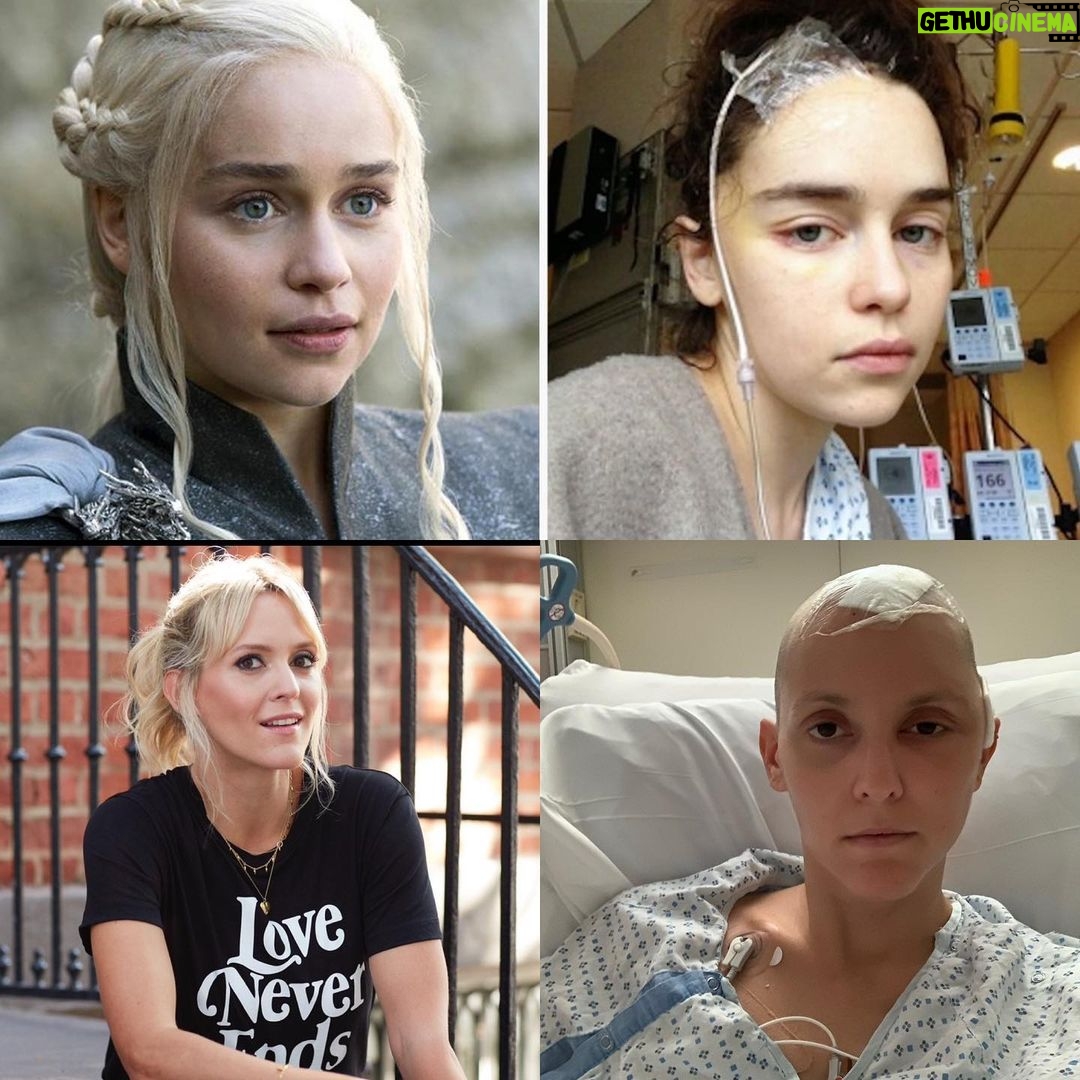 Emilia Clarke Instagram - Brain injury will affect 1/3 people in their lifetime. That’s one-third of all people globally. Not just the elderly or the catastrophically unlucky. Even the fantastically lucky who survive major brain injuries, like the amazing @emilia_clarke - who was very young, 24, when her first aneurysm began bleeding - or (young-ish) me - I was 38 when a previously undetected AVM ruptured, ending my ability to speak, compute language, move my right side; in short my life as I knew it. Recovery from brain injury is an exhausting, complex, complicated, multi-factorial and well-nigh 24/7 constant struggle, even for those of us who have the privilege of getting to try. But brain injury is still not talked about. And provision of vital services and care are not prioritised, even for the young people who might be able to give back to their communities and societies in a very meaningful way in the future. Long-term critical neuro-rehabilitation and support are - even in the most medically advanced societies like the US and UK - practically nonexistent. That’s why @emilia_clarke founded @sameyouorg with her amazing mum Jenny. And thanks to the phenomenal generosity of an anonymous donor in New York, *for the next 24 hours only*, ANY pledge of any donation, large and small, with no limit, will be 100% matched. That is unbelievable. The match offer will finish tomorrow night, Friday 17th February. Obviously, we would be grateful to have your donation anytime, but if you have ever thought of supporting this very worthwhile cause, it would mean the world to us if you could find it in your heart to support SameYou’s vital mission and dig deep into your pockets TODAY to maximise the power of your donation. I hate to scaremonger/point out the obvious, but on those odds, 1/3 of all people, it’s probably not unlikely that you or someone you love will need care for brain injury at some point in the future. Thank you for all your support. It is so appreciated. Link in bio or visit SameYou.org 🙏🧠♥️ #braininjury