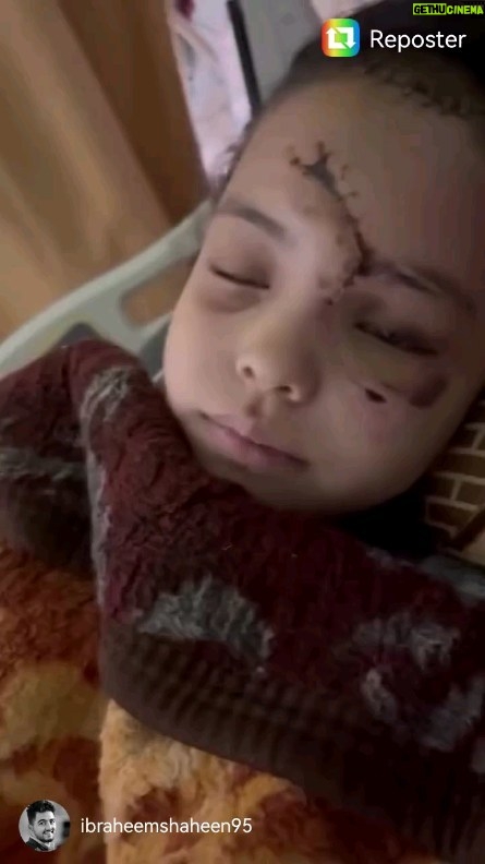 Giorgia Wurth Instagram - Guardate gli occhi di questa bambina palestinese di 9 anni. Il medico le sta chiedendo quale sia il suo sogno. Lei risponde: che la guerra finisca. Per sempre. E i suoi occhi si accendono di una luce che acceca tanto è potente. Lei è il bersaglio delle bombe di Israele, Casa Bianca e Commissione Europea. Conoscete qualcuno di più vigliacco e schifoso? @giorgiameloni @europeancommission @ursulavonderleyen #stopgenocide