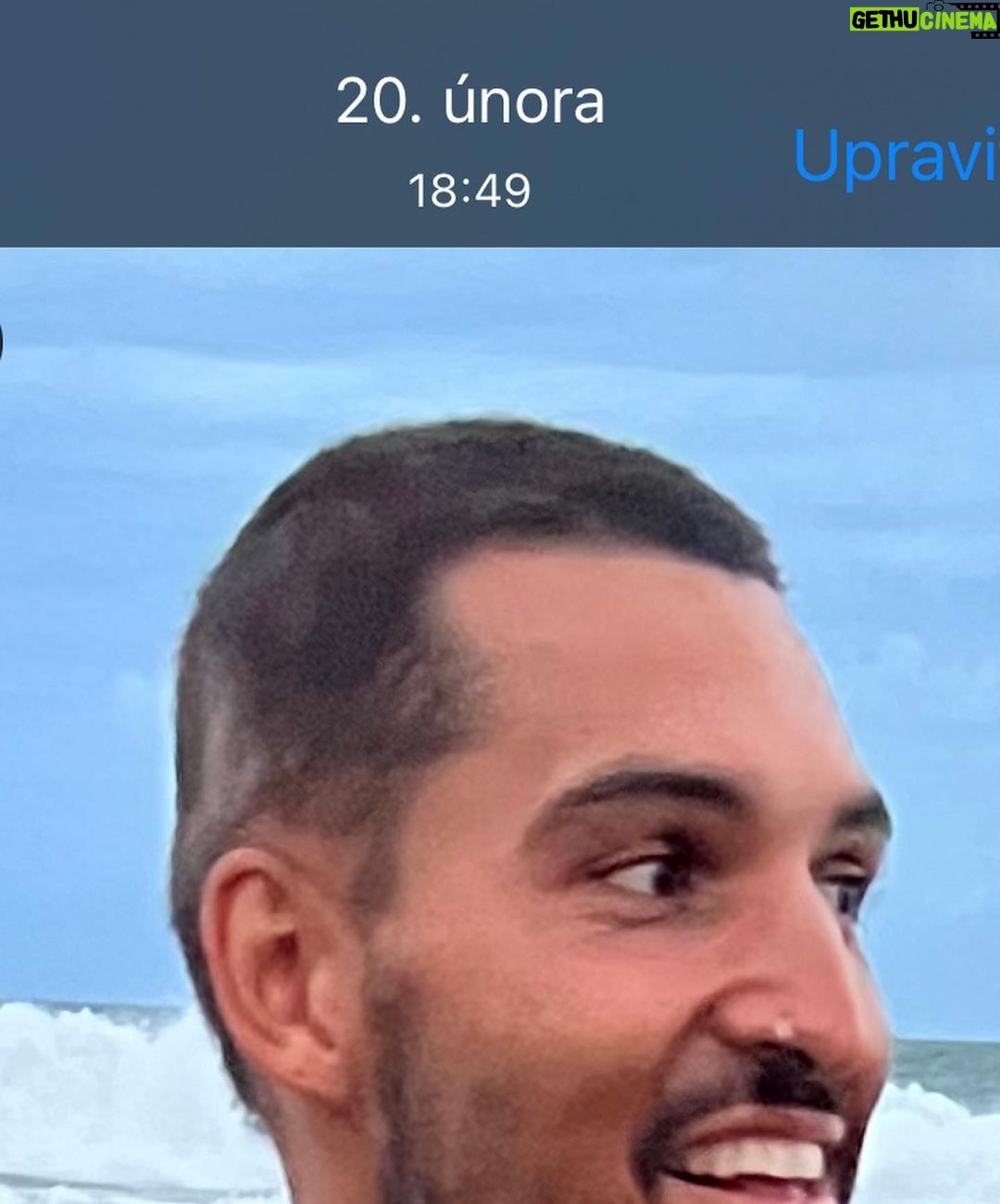 Jordan Haj Instagram - Ze 100% zarostlá ALOPECIE zítra 13:30 Q&A a livestream s Dr. Která mi to vyléčila. O léčbě co jsem absolvoval já, o tom jestli je to jistota, když to zkusíš léčit stejně, a o dalších možnostech léčby. Už delší dobu mi denodenně chodí dotazy na téma alopecie a já se snažím odpovídat svemdomitě ale vlastně na většinu otázek eridované odpovědi samozřejmě nemám. Budu zítra (neboli dnes, v pondělí 19.6.) Na kontrole u paní doktorkorky @monika_arenbergerova ve vinohradské nemocnici a poprosil jsem ji, jestli by se mnou neudělala livestream ke kterému by se mohli připojit ti, co mi píší dotazy a dostat odpovědi připmo od ní. zkusím to tu pak uložit s co nejobsáhlejším pokrytím toho jak jsem to k současnému úspěchu(snad na co nejdéle trvajícímu) absolvoval pod jejím dozorem a péčí já.