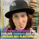 Joséphine Draï Instagram – Et vous, avez-vous déjà eu recours à des injections d’acide hyaluronique illégales ?