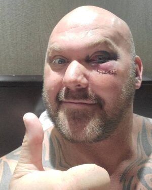 Josh Burns Instagram - Sup everyone, just wanted to give my post fight thoughts. 

First I wanna say thank you to all of you for the support and love shown to me every fight. I know there were a lot of fight parties watching me and the love is felt so..... Thank you.  Also to haters and naysayers that continue to drive me as well. Without all of you none of this would be possible. 

Now Friday night was definitely a rough night at work... Things honestly just didn't materialize or come together the way I thought they would. Huge respect to my opponent Frank Tate, he did what he had to and got the W so congrats to him. I've been in this game for more than 16yrs and if you stay long enough you'll always run into a first. I did exactly that ran into my first time being on my butt. Definitely a crazy (shitty) feeling. To be honest that's what was going through my head at the time too... (can you believe that shit?! 🤦🏼‍♂️😂 but hey the world slows down in that squared circle). Anyway I'm well few bumps, bruises and stitches but all is good. I'm going to rest up a lil and then sit down with Mark Coleman and Victor Torres to map out the game plan. We learn and move forward, I still want the HW strap and I will accomplish my goal.... #facts  Thank you again guys!

(Just wanted to say thank you to Vic and Kevin for taking care of me after the fight #respect)

#hammerhouse4life #terphousefarmz #BKFC #tigerlyfe #smithbrotherscombatesports
