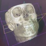 Kari Byron Instagram - NeuroSkeletal Dentistry is used to treat depression and PTSD at the VA hospital in San Francisco. Imagine treating the brain without pills. I love exploring new sciences.
