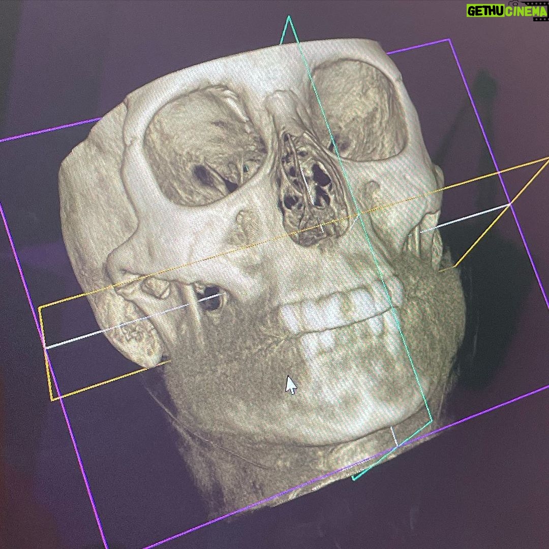 Kari Byron Instagram - NeuroSkeletal Dentistry is used to treat depression and PTSD at the VA hospital in San Francisco. Imagine treating the brain without pills. I love exploring new sciences.