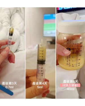 Kerstin Chan Instagram - 生完就能安心睡是騙人的!!!🥲
塞奶大魔王 有經歷過的人都知道多痛苦
睡覺翻個身都會被痛醒
光是衣服摩擦到都想尖叫
衷心建議不管是要餵母奶還是離乳
都先找好專業顧問
我也是聽朋友的話
產前就做好功課以備不時之需
避免塞成乳腺炎

跟過來人說的一樣
才生完3-5天
胸部的硬度腫度疼痛度 
都比我想像來的劇烈太多
最讓新手產婦無力的是
又塞又痛但靠自己卻排不出奶
隔天一早 毫不猶豫趕緊求救我的哺育顧問 

原本努力快一小時 脖子痠到快斷了 
拿著空針筒一滴滴吸
才能收集到0.7ml
真的是每一滴都好珍貴 滴滴皆辛苦🥲
不過在顧問幫忙後 乳腺瞬間通暢 
實在是太驚人了
一邊擠一邊驚呼 
原來塞了這麼多乳汁
難怪胸部腫成自己都認不得的樣子

經過專業協助後
隔天自己輕鬆擠 就邁向40ml
那一刻真的是含淚感謝泌乳師解救🥹
加上受過正確手法指導
手擠奶也順利很多很多很多~

我原本就決定採漸進式退奶
跟顧問討論過離乳規劃
決定以非常非常慢 溫和的方式退 
比較不怕影響胸型 
在意這點的女生
建議一定要找顧問討論
生完後會感謝過去的自己
我也很感謝跟我分享經驗的朋友

我一路佛系餵母乳 
只排出部分乳汁 讓胸部減輕腫脹感 
加上喝麥芽水
以自然的方式龜速退奶
前後花了1個月的時間 
前幾天顧問終於宣布我離乳完成啦🥳

超級感謝 @merimommy 
在我無助時及時的回覆
立刻安排顧問到月中拯救我
後續持續追蹤我的胸部狀況

接著我還約了寶寶按摩課
顧問帶我依照講義上步驟
一步步學習按摩手法
希望在嫩嬰脹氣 腸絞痛時
自己知道如何有效幫忙舒緩
現在按摩也成了我們的睡前儀式
希望讓寶寶放鬆舒服早早睡過夜
還給爸媽充足的睡眠💙

以下附上資訊 分享給需要的朋友👇
🫶🏻宣媽媽哺育顧問 
官網：https://www.merimommy.com/
預約專線：0800-027-580
Line@預約ID：@merimommy (前面須加@)
工作室地址：臺北市忠孝東路四段222號9樓