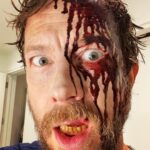 Kristen Holden-Ried Instagram – Sorry I’ve been so quiet lately. 

Been dealing with some personal issues…

All good now! 👍😜

But I think I should brush my teeth.

#oralhygiene #justafleshwound