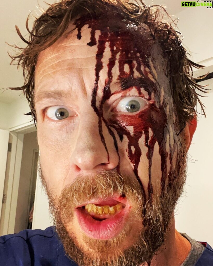 Kristen Holden-Ried Instagram - Sorry I’ve been so quiet lately. Been dealing with some personal issues… All good now! 👍😜 But I think I should brush my teeth. #oralhygiene #justafleshwound