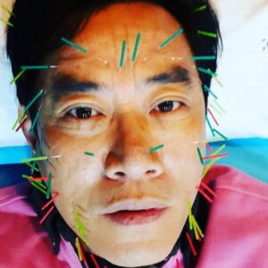 Lee Kyung-kyu Instagram - 안뇽  경규♡조금이라도 젊어 지겠다고 맞은 침 #상처와 아픔만 남기고  ㅋ ㅋ