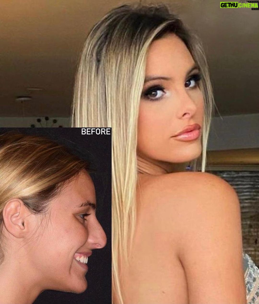 Lele Pons Instagram - 8 years ago today i got my nose job… Can you tell? 🤣 HAPPY ANNIVERSARY @drkassir