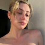 Lili Reinhart Instagram - Since I was 12, I’ve struggled with acne. My skin has suffered consistent breakouts, hyperpigmentation, redness and scarring. I feel impassioned and motivated to find solutions for not only myself, but others who struggle as well. This is my skin now, makeup free… no filter. I can’t wait to share more about what I’ve been working on 🧚🏻‍♂️