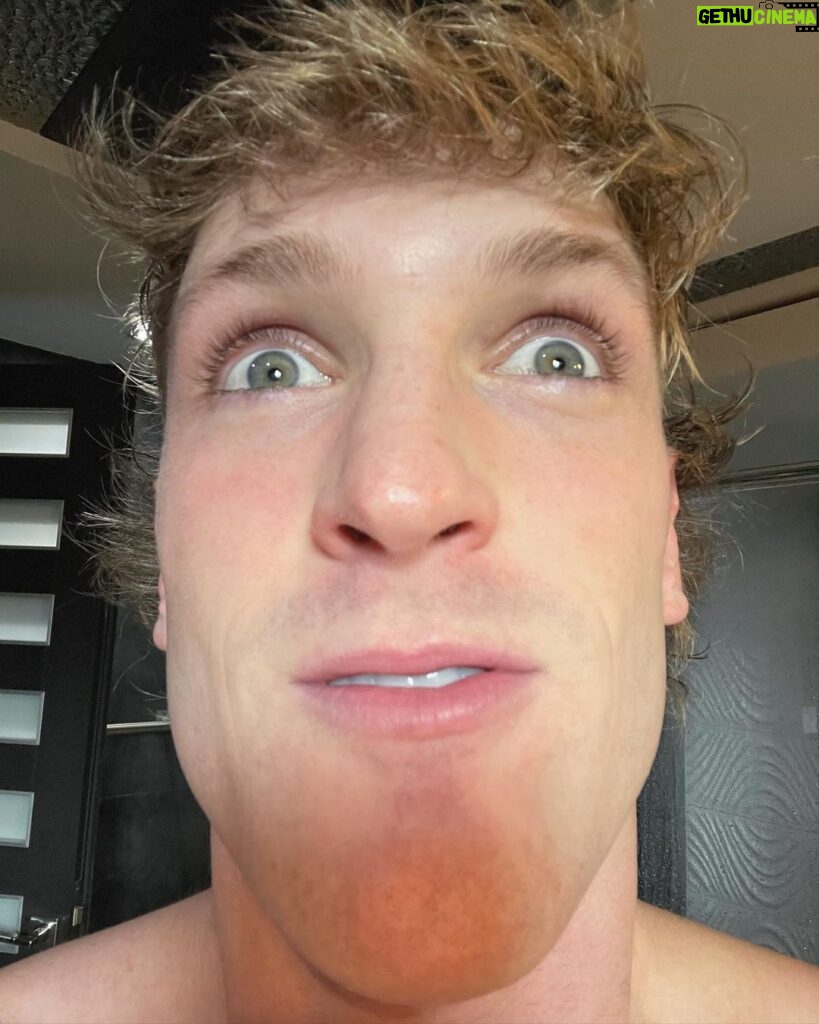 Logan Paul Instagram - what have i done