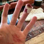 Louise Brealey Instagram – Preparation for #BAFTAs tomorrow with #brianandcharlesmovie is underway. Pedicure? Check. Allergic reaction at local salon to eyelash tint? Check. Slice finger instead of pear with bread knife like a twat? Check.