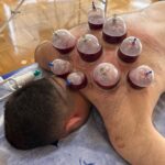 Müşfiq Şahverdiyev Instagram - Dostlar 1 ilden coxdu gedecem gedecem deyib axir ki bu gun gedib hicama olundum ve ilk deqiqeden effektini his etdim gozume ishig geldi bedenimizde olan o zeherli toksinleri bedenden temizlendikden sora adam ozunu cox gumrah hiss edir😉😃👍teshekkurler @hicama_ibrahim 👈