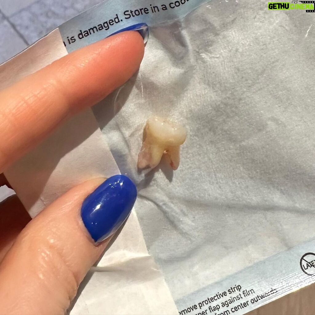 Madelaine Petsch Instagram - bye bye baby (tooth) 🦷