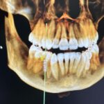 Madelaine Petsch Instagram - bye bye baby (tooth) 🦷