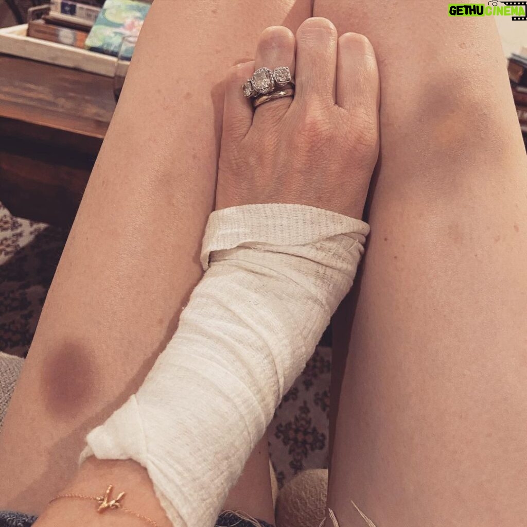 Rachel Nichols Instagram - I’m doing great. Great! “Burns and bruises” - that’s my middle name. I have been a clumsy klutz since birth, so…why quit now? 😂.